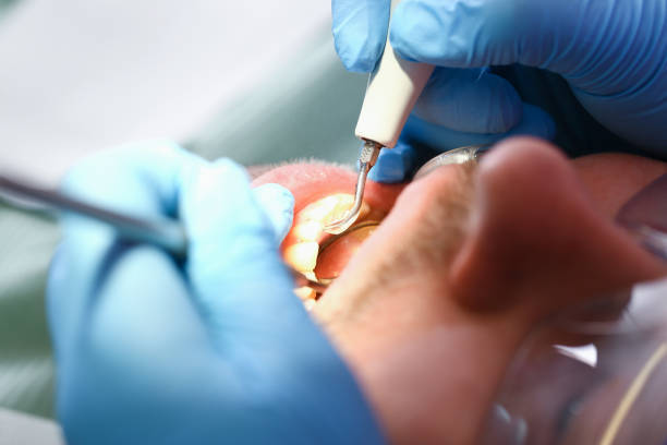 Best Emergency Dental Care for Trauma or Injury in St John, MO