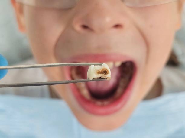 Best Pediatric Emergency Dentist in St John, MO